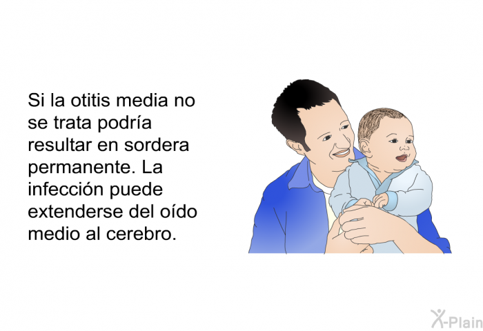 Si la otitis media no se trata podra resultar en sordera permanente. La infeccin puede extenderse del odo medio al cerebro.