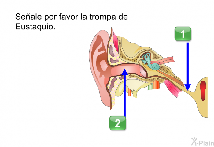 Seale por favor la trompa de Eustaquio.