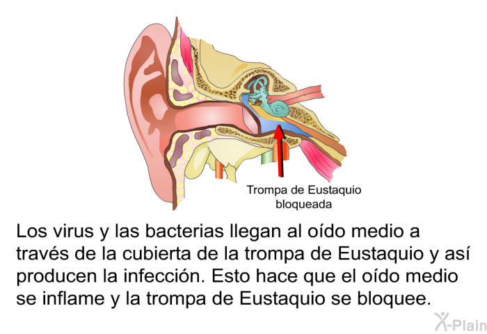 Los virus y las bacterias llegan al odo medio a travs de la cubierta de la trompa de Eustaquio y as producen la infeccin. Esto hace que el odo medio se inflame y la trompa de Eustaquio se bloquee. 