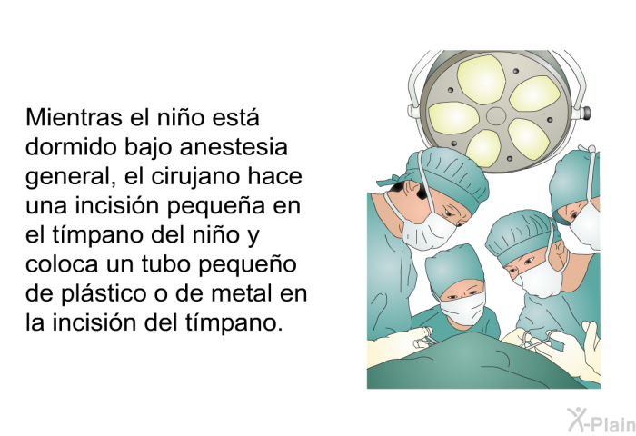 Mientras el ni�o est� dormido bajo anestesia general, el cirujano hace una incisi�n peque�a en el t�mpano del ni�o y coloca un tubo peque�o de pl�stico o de metal en la incisi�n del t�mpano.