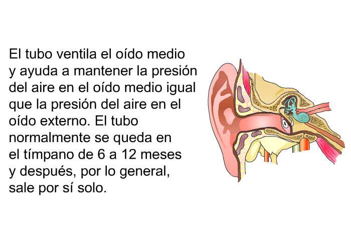El tubo ventila el o�do medio y ayuda a mantener la presi�n del aire en el o�do medio igual que la presi�n del aire en el o�do externo. El tubo normalmente se queda en el t�mpano de 6 a 12 meses y despu�s, por lo general, sale por s� solo.