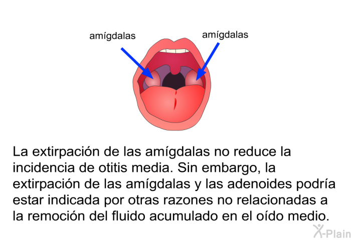 La extirpaci�n de las am�gdalas no reduce la incidencia de otitis media. Sin embargo, la extirpaci�n de las am�gdalas y las adenoides podr�a estar indicada por otras razones no relacionadas a la remoci�n del fluido acumulado en el o�do medio.&nbsp;