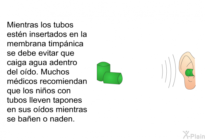 Mientras los tubos est�n insertados en la membrana timp�nica se debe evitar que caiga agua adentro del o�do. Muchos m�dicos recomiendan que los ni�os con tubos lleven tapones en sus o�dos mientras se ba�en o naden.&nbsp;