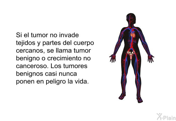 Si el tumor no invade tejidos y partes del cuerpo cercanos, se llama tumor benigno o crecimiento no canceroso. Los tumores benignos casi nunca ponen en peligro la vida.