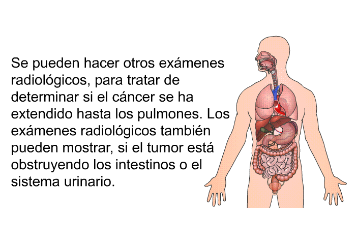 Se pueden hacer otros ex�menes radiol�gicos, para tratar de determinar si el c�ncer se ha extendido hasta los pulmones. Los ex�menes radiol�gicos tambi�n pueden mostrar, si el tumor est� obstruyendo los intestinos o el sistema urinario.