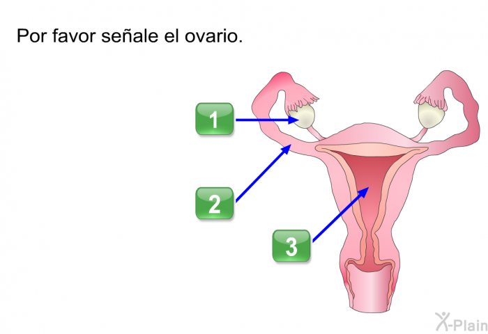 Por favor seale el ovario.