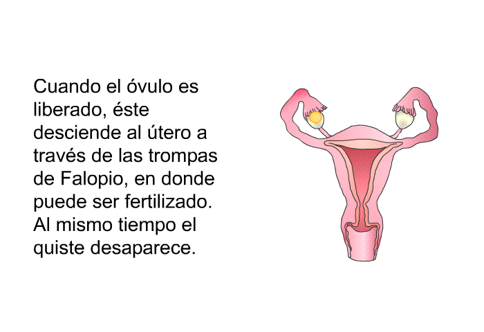 Cuando el vulo es liberado, ste desciende al tero a travs de las trompas de Falopio, en donde puede ser fertilizado. Al mismo tiempo el quiste desaparece. 