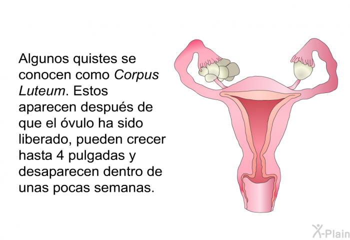 Algunos quistes se conocen como <I>Corpus Luteum</I>. Estos aparecen despus de que el vulo ha sido liberado, pueden crecer hasta 4 pulgadas y desaparecen dentro de unas pocas semanas.