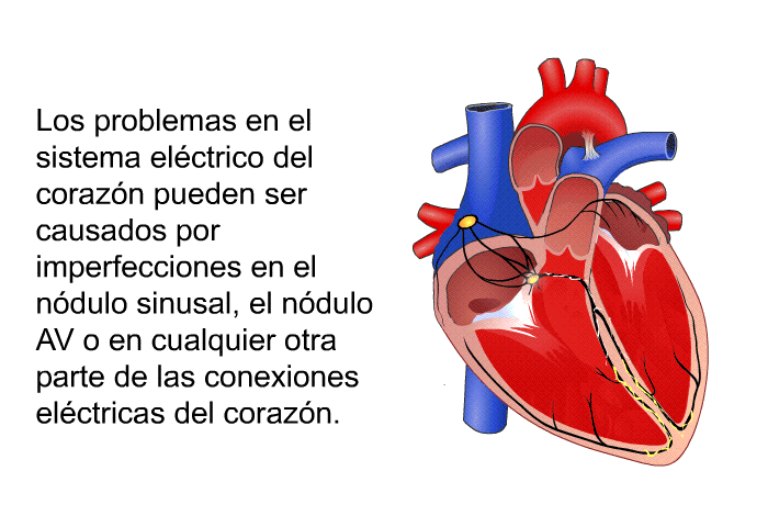 Los problemas en el sistema elctrico del corazn pueden ser causados por imperfecciones en el ndulo sinusal, el ndulo AV o en cualquier otra parte de las conexiones elctricas del corazn.