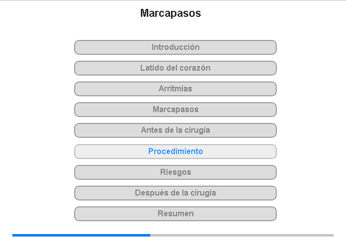 Procedimiento