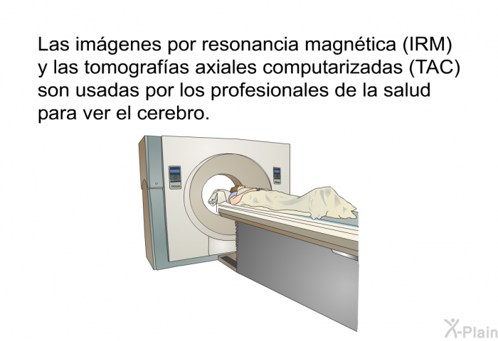 Las imgenes por resonancia magntica (IRM) y las tomografas axiales computarizadas (TAC) son usadas por los profesionales de la salud para ver el cerebro.