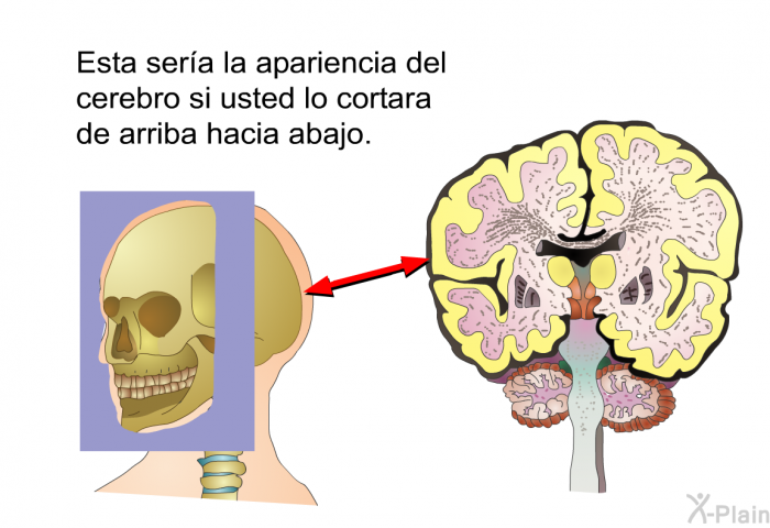 Esta sera la apariencia del cerebro si usted lo cortara de arriba hacia abajo.