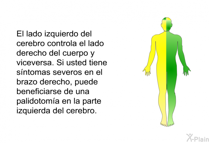 El lado izquierdo del cerebro controla el lado derecho del cuerpo y viceversa. Si usted tiene s�ntomas severos en el brazo derecho, puede beneficiarse de una palidotom�a en la parte izquierda del cerebro.