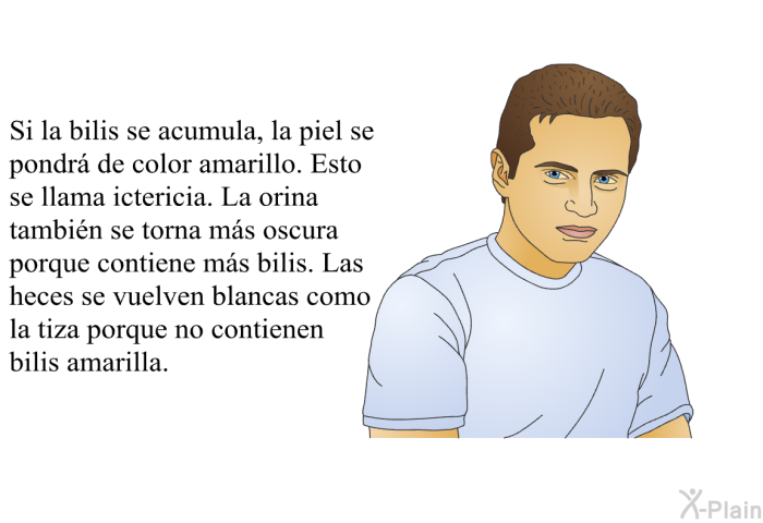 Si la bilis se acumula, la piel se pondr de color amarillo. Esto se llama ictericia. La orina tambin se torna ms oscura porque contiene ms bilis. Las heces se vuelven blancas como la tiza porque no contienen bilis amarilla.