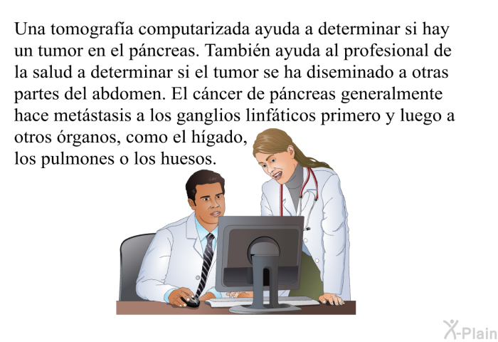 Una tomografa computarizada ayuda a determinar si hay un tumor en el pncreas. Tambin ayuda al profesional de la salud a determinar si el tumor se ha diseminado a otras partes del abdomen. El cncer de pncreas generalmente hace metstasis a los ganglios linfticos primero y luego a otros rganos, como el hgado, los pulmones o los huesos.