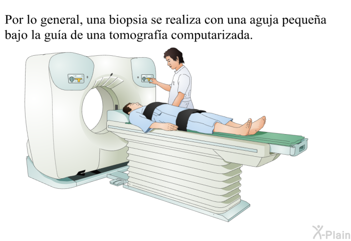 Por lo general, una biopsia se realiza con una aguja pequea bajo la gua de una tomografa computarizada.
