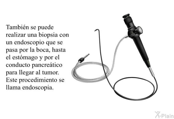Tambin se puede realizar una biopsia con un endoscopio que se pasa por la boca, hasta el estmago y por el conducto pancretico para llegar al tumor. Este procedimiento se llama endoscopia.