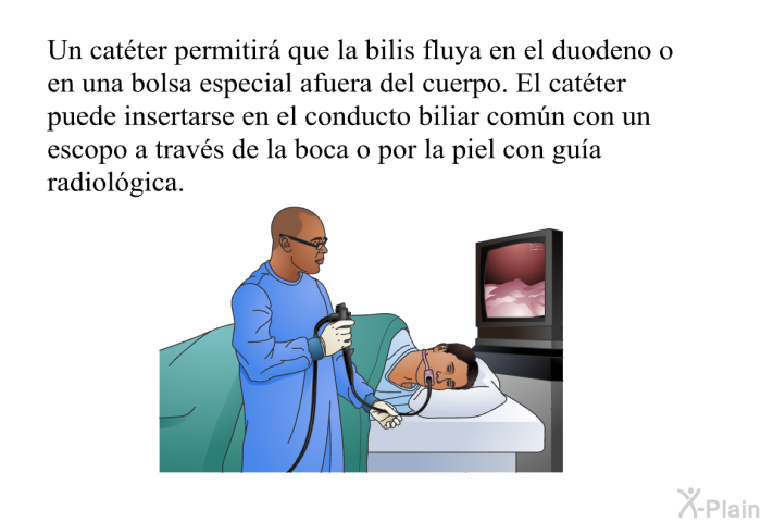 Un catter permitir que la bilis fluya en el duodeno o en una bolsa especial afuera del cuerpo. El catter puede insertarse en el conducto biliar comn con un escopo a travs de la boca o por la piel con gua radiolgica.