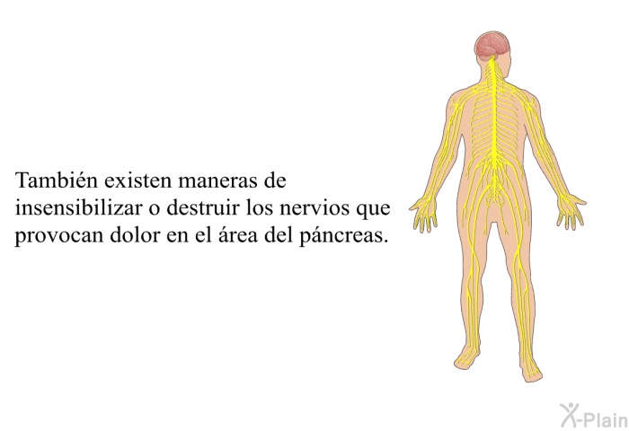 Tambin existen maneras de insensibilizar o destruir los nervios que provocan dolor en el rea del pncreas.
