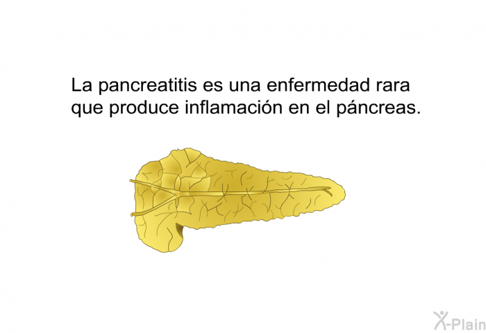 La pancreatitis es una enfermedad rara que produce inflamacin en el pncreas.