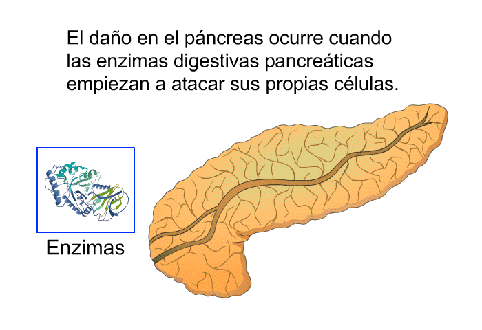 El da�o en el p�ncreas ocurre cuando las enzimas digestivas pancre�ticas empiezan a atacar sus propias c�lulas.