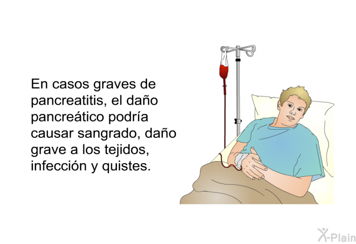 En casos graves de pancreatitis, el dao pancretico podra causar sangrado, dao grave a los tejidos, infeccin y quistes.