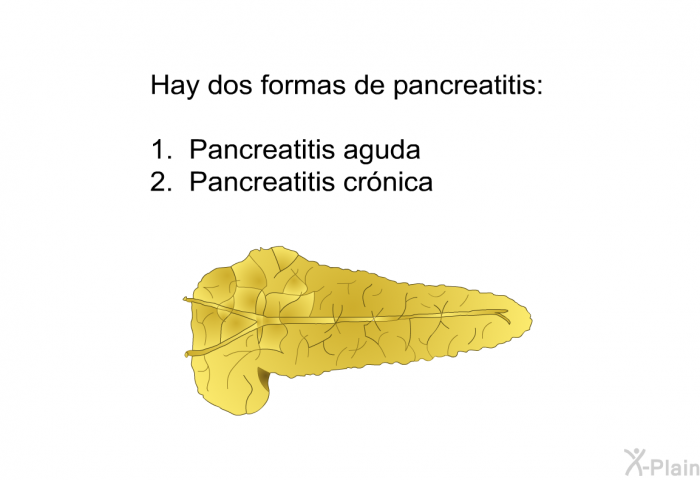 Hay dos formas de pancreatitis:  pancreatitis aguda pancreatitis crnica