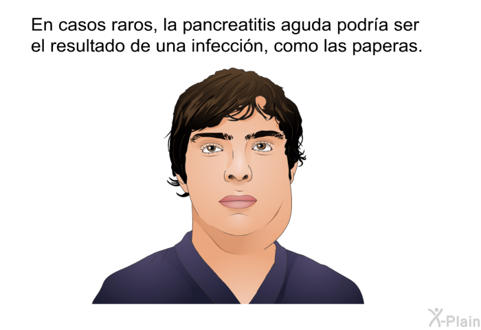 En casos raros, la pancreatitis aguda podr�a ser el resultado de una infecci�n, como las paperas.