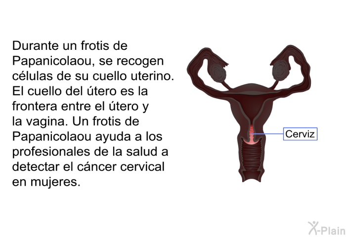 Durante un frotis de Papanicolaou, se recogen c�lulas de su cuello uterino. El cuello del �tero es la frontera entre el �tero y la vagina. Un frotis de Papanicolaou ayuda a los profesionales de la salud a detectar el c�ncer cervical en mujeres.