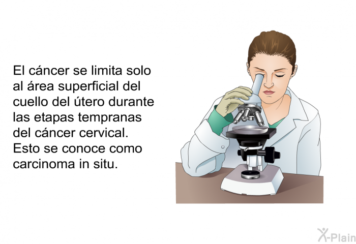 El cncer se limita solo al rea superficial del cuello del tero durante las etapas tempranas del cncer cervical. Esto se conoce como carcinoma <I>in situ</I>.