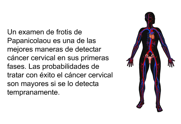 Un examen de frotis de Papanicolaou es una de las mejores maneras de detectar cncer cervical en sus primeras fases. Las probabilidades de tratar con xito el cncer cervical son mayores si se lo detecta tempranamente.
