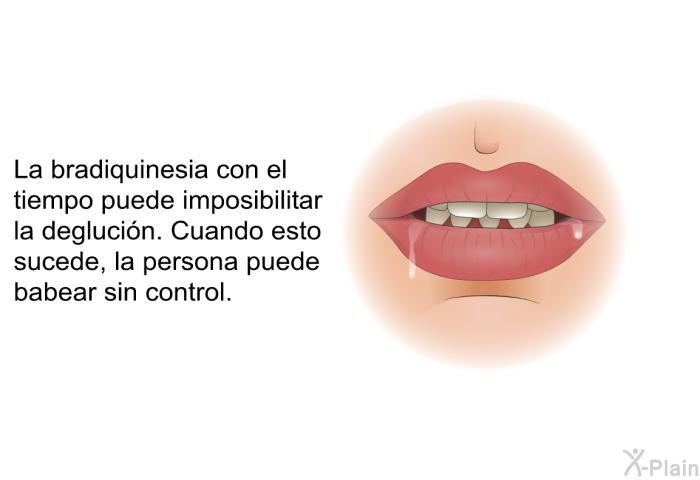 La bradiquinesia con el tiempo puede imposibilitar la deglucin. Cuando esto sucede, la persona puede babear sin control.