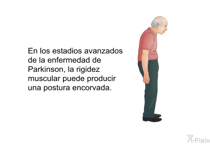 En los estadios avanzados de la enfermedad de Parkinson, la rigidez muscular puede producir una postura encorvada.