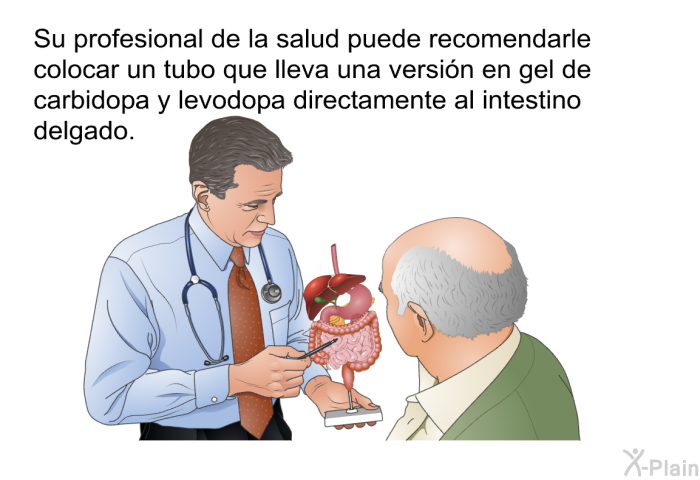 Su profesional de la salud puede recomendarle colocar un tubo que lleva una versin en gel de carbidopa y levodopa directamente al intestino delgado.