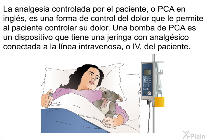 La analgesia controlada por el paciente, o PCA en ingls, es una forma de control del dolor que le permite al paciente controlar su dolor. Una bomba de PCA es un dispositivo que tiene una jeringa con analgsico conectada a la lnea intravenosa, o IV, del paciente.