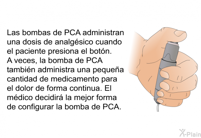 Las bombas de PCA administran una dosis de analgsico cuando el paciente presiona el botn. A veces, la bomba de PCA tambin administra una pequea cantidad de medicamento para el dolor de forma continua. El mdico decidir la mejor forma de configurar la bomba de PCA.