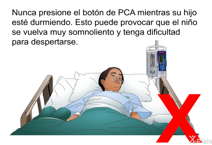 Nunca presione el botn de PCA mientras su hijo est durmiendo. Esto puede provocar que el nio se vuelva muy somnoliento y tenga dificultad para despertarse.