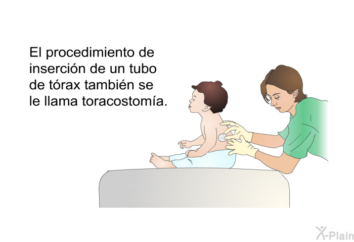 El procedimiento de insercin de un tubo de trax tambin se le llama toracostoma.