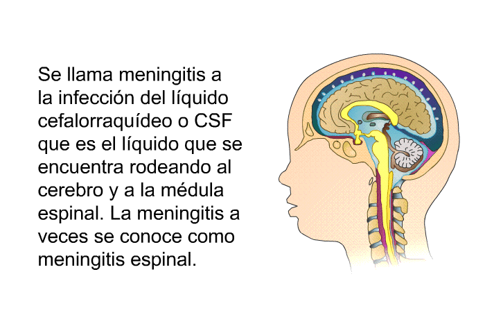 Se llama meningitis a la infeccin del lquido cefalorraqudeo o CSF que es el lquido que se encuentra rodeando al cerebro y a la mdula espinal. La meningitis a veces se conoce como meningitis espinal.