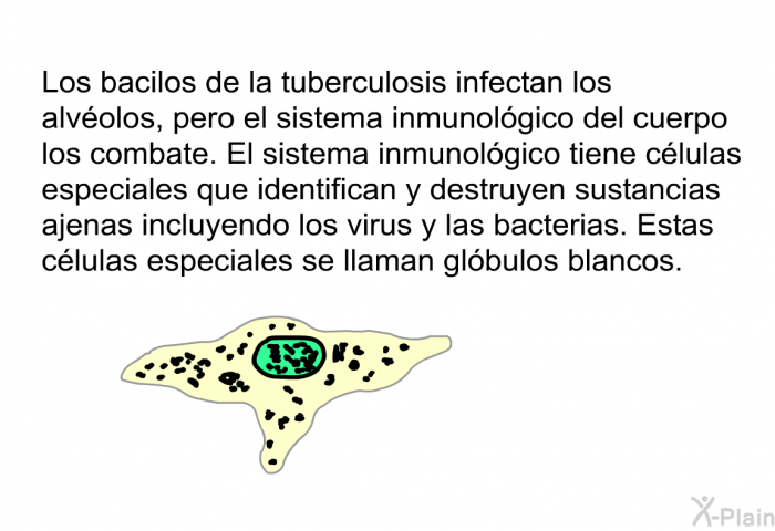 Los bacilos de la tuberculosis infectan los alvolos, pero el sistema inmunolgico del cuerpo los combate. El sistema inmunolgico tiene clulas especiales que identifican y destruyen sustancias ajenas incluyendo los virus y las bacterias. Estas clulas especiales se llaman glbulos blancos.