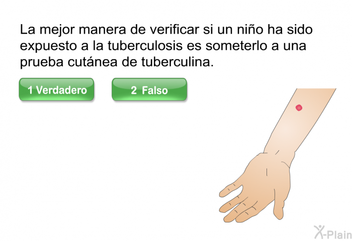 La mejor manera de verificar si un nio ha sido expuesto a la tuberculosis es someterlo a una prueba cutnea de tuberculina. Presione Verdadero o Falso.