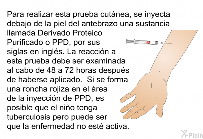 Para realizar esta prueba cutnea, se inyecta debajo de la piel del antebrazo una sustancia llamada Derivado Proteico Purificado o PPD, por sus siglas en ingls. La reaccin a esta prueba debe ser examinada al cabo de 48 a 72 horas despus de haberse aplicado. Si se forma una roncha rojiza en el rea de la inyeccin de PPD, es posible que el nio tenga tuberculosis pero puede ser que la enfermedad no est activa.