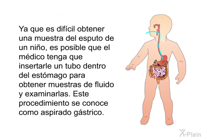 Ya que es difcil obtener una muestra del esputo de un nio, es posible que el mdico tenga que insertarle un tubo dentro del estmago para obtener muestras de fluido y examinarlas. Este procedimiento se conoce como aspirado gstrico.