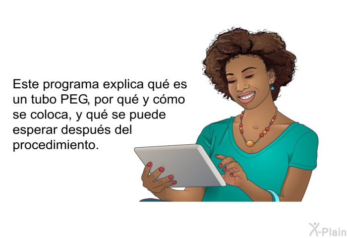 Este informacin acerca de su salud explica qu es un tubo PEG, por qu y cmo se coloca, y qu se puede esperar despus del procedimiento.