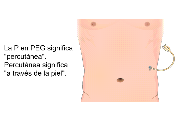 La P en PEG significa “percutnea”. Percutnea significa “a travs de la piel”.
