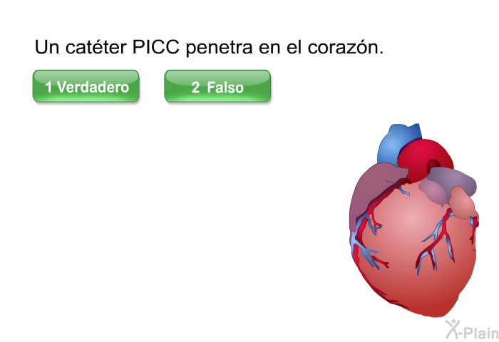 Un catter PICC penetra en el corazn.