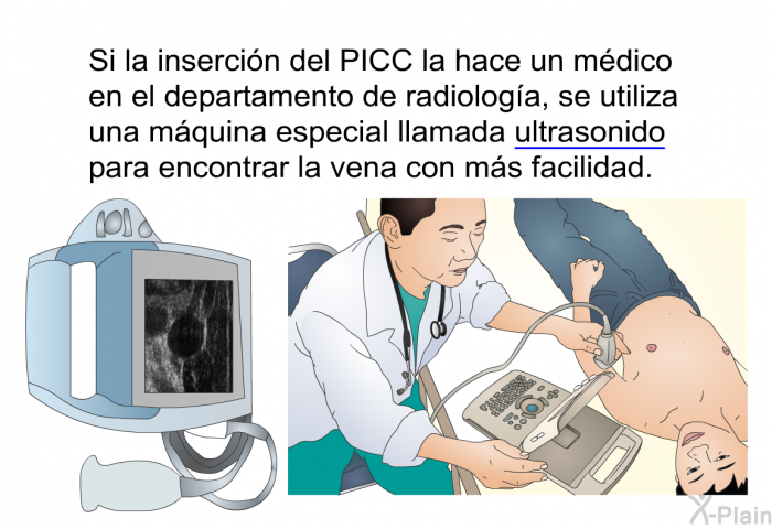 Si la insercin del PICC la hace un mdico en el departamento de radiologa, se utiliza una mquina especial llamada ultrasonido para encontrar la vena con ms facilidad.