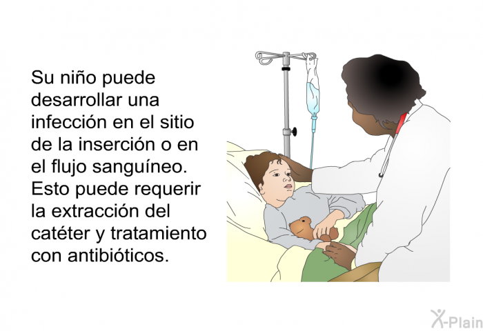 Su ni�o puede desarrollar una infecci�n en el sitio de la inserci�n o en el flujo sangu�neo. Esto puede requerir la extracci�n del cat�ter y tratamiento con antibi�ticos.