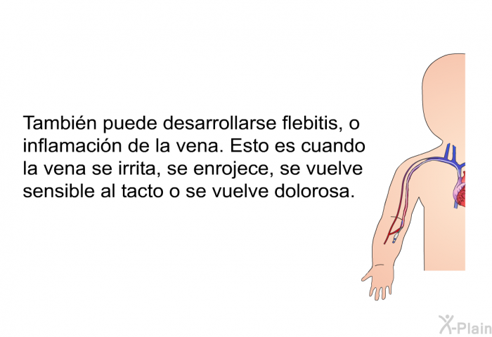 Tambi�n puede desarrollarse flebitis, o inflamaci�n de la vena. Esto es cuando la vena se irrita, se enrojece, se vuelve sensible al tacto o se vuelve dolorosa.