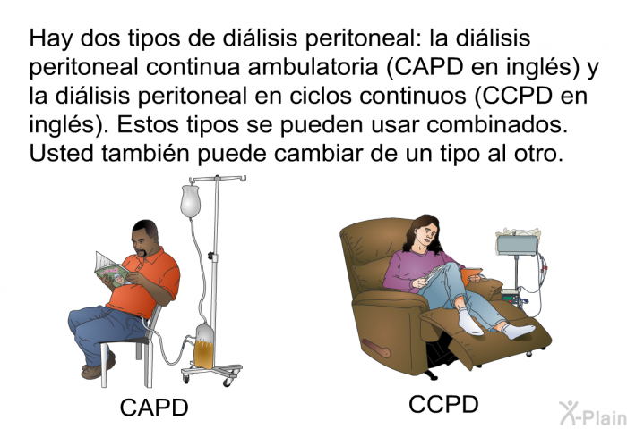 Hay dos tipos de dilisis peritoneal: la dilisis peritoneal continua ambulatoria (CAPD en ingls) y la dilisis peritoneal en ciclos continuos (CCPD en ingls). Estos tipos se pueden usar combinados. Usted tambin puede cambiar de un tipo al otro.